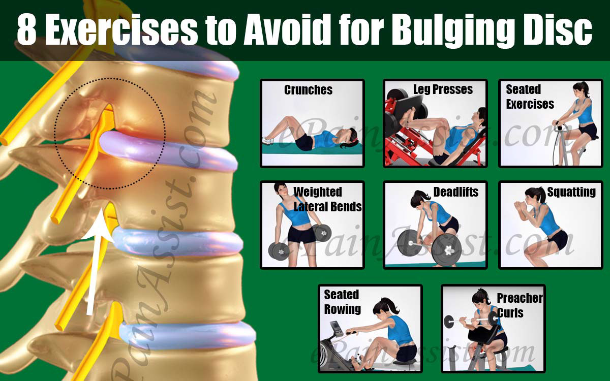 Exercises To Avoid For Bulging Disc