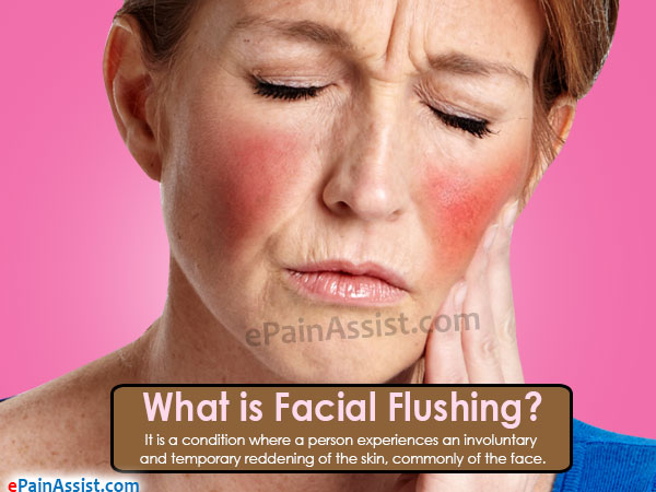 Reduce facial flushing