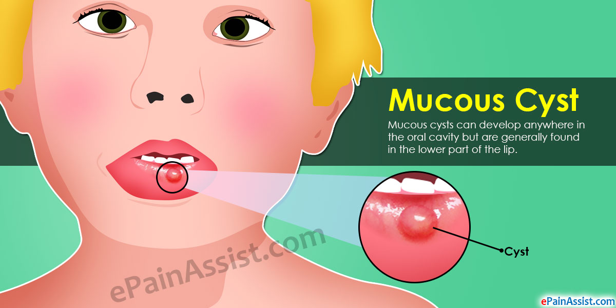 Mucous In Mouth Porn Website Name