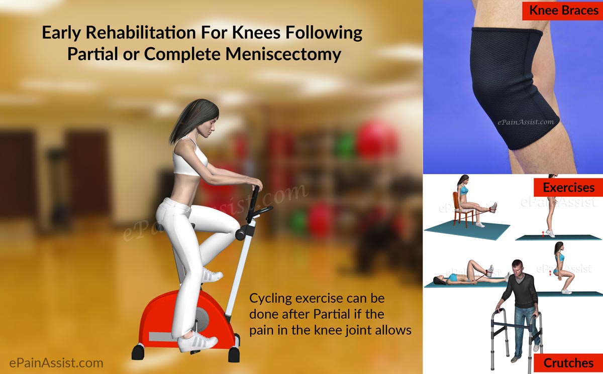 How Long Does it Take to Rehab From Meniscus Surgery?