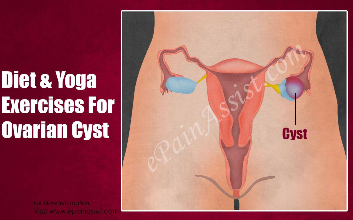 natural ways to remove ovarian cyst｜TikTok Search