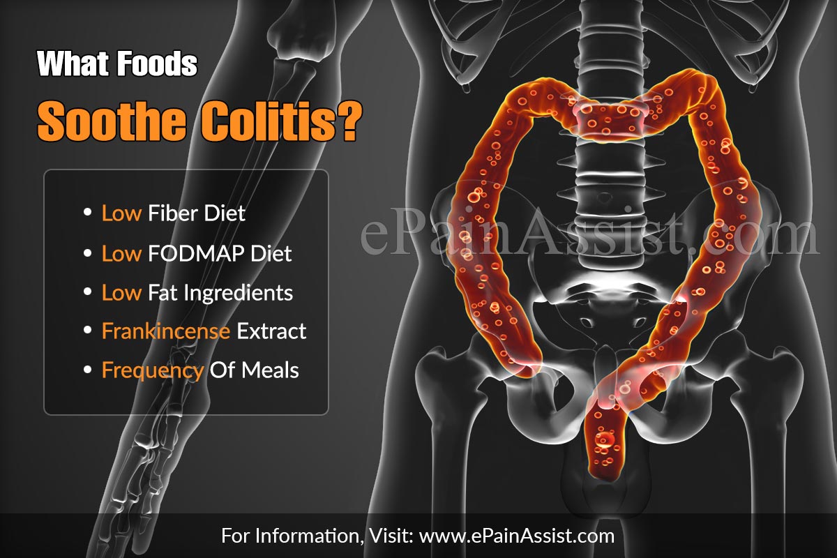 What Foods Soothe Colitis?