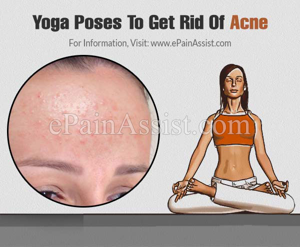 The yoga poses that treat PCOS revealed! - Organic Apoteke