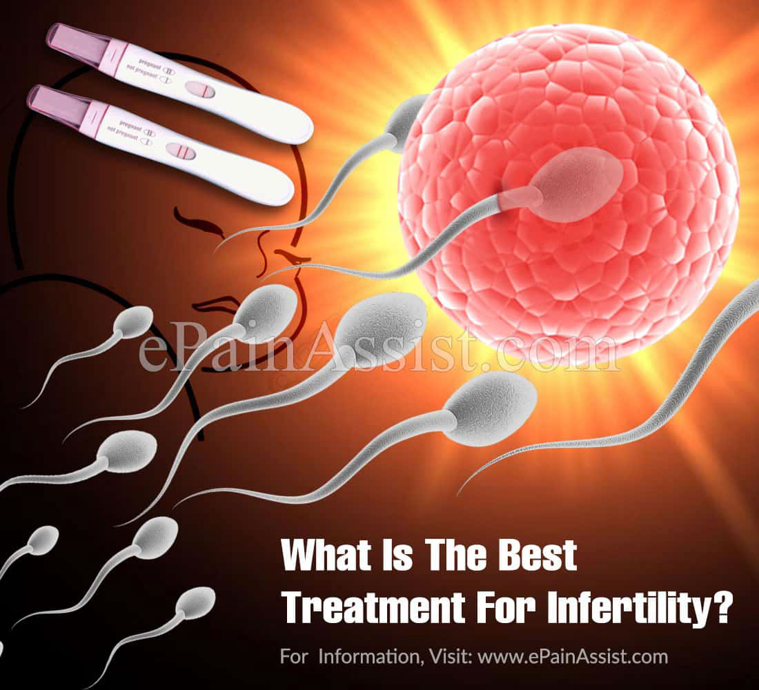 What Is The Best Treatment For Infertility