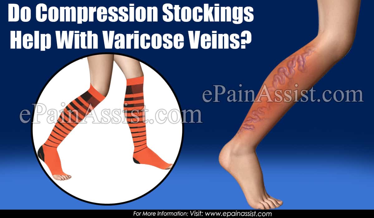 Breathable Varicose Veins Treat Sports Leggings Women Unisex