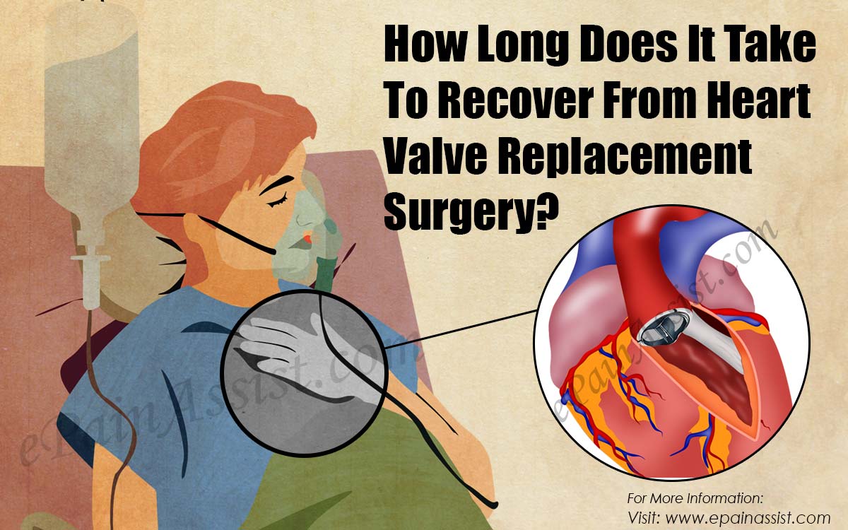 How Long Can You Live After Heart Valve Replacement