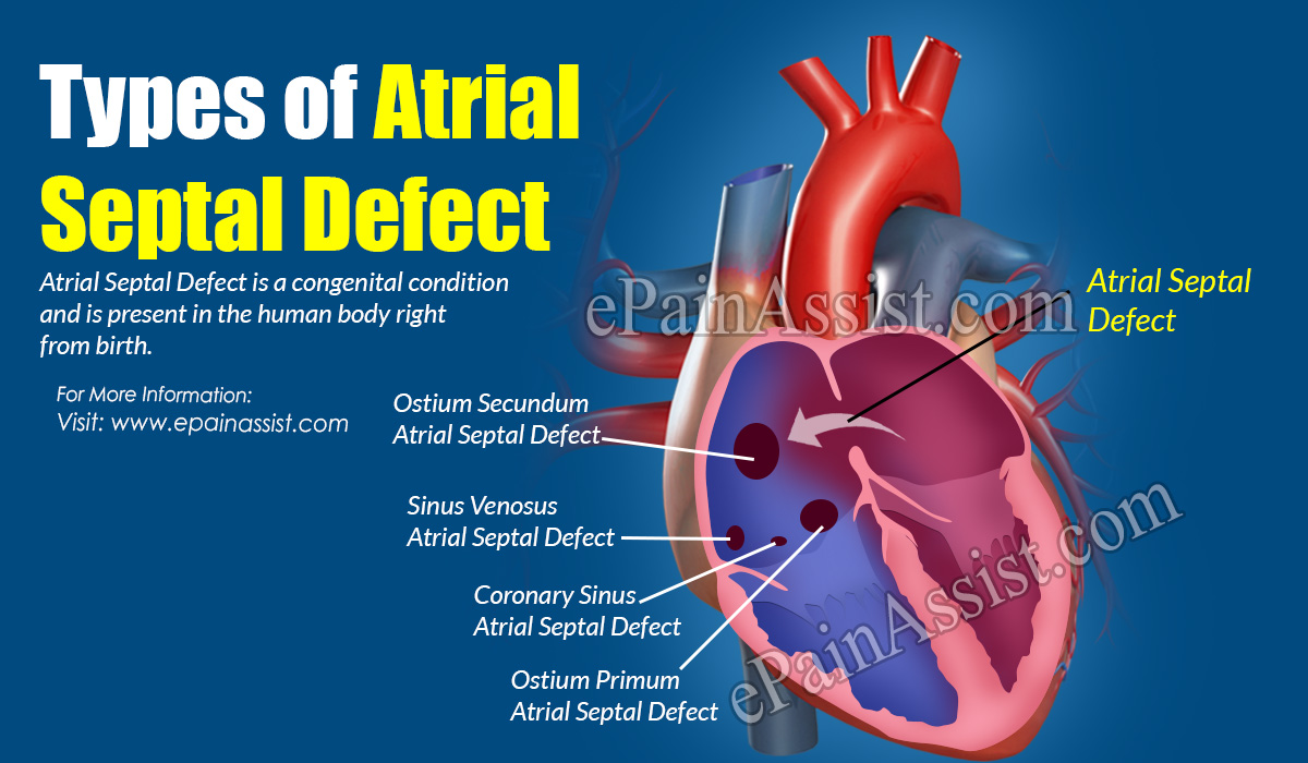 Types of Atrial Septal Defect