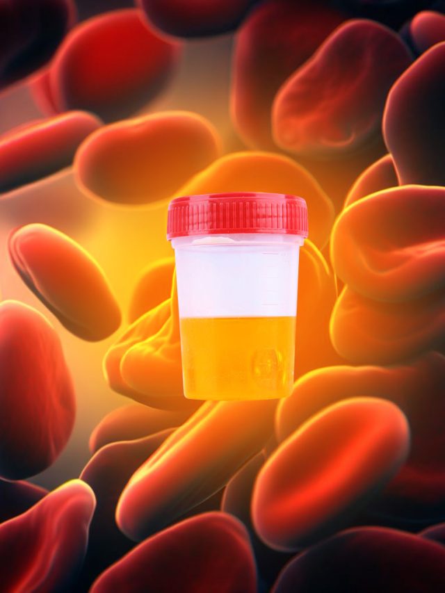 Hematuria-Friendly Foods: Eating Right to Address Blood in Urine