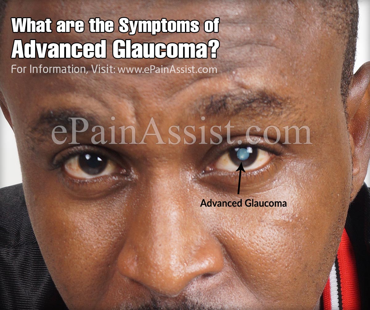 What are the Symptoms of Advanced Glaucoma?