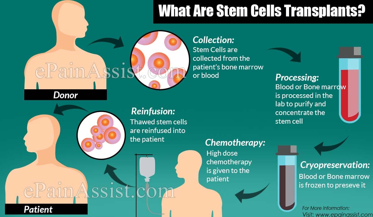 stem cell transplant