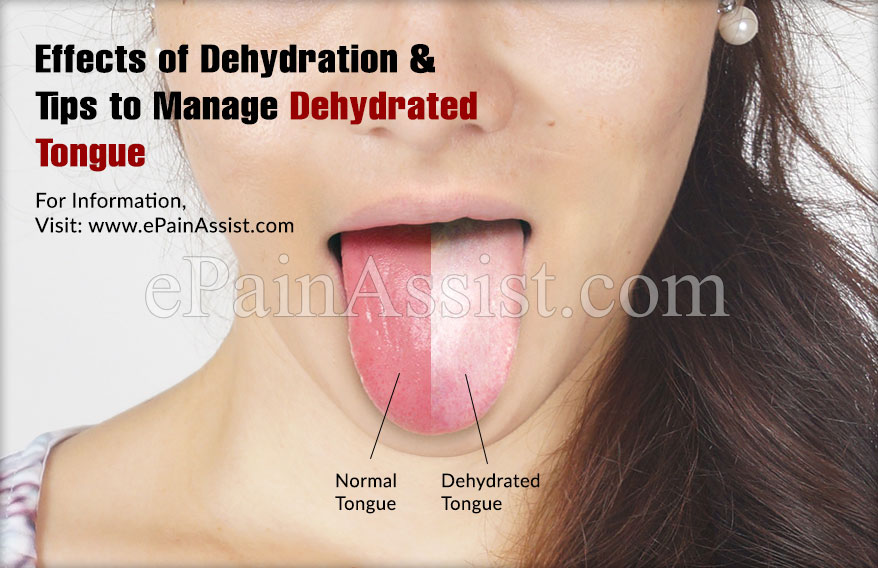 Tongue : Effects Dehydration & Tips to Manage Dehydrated