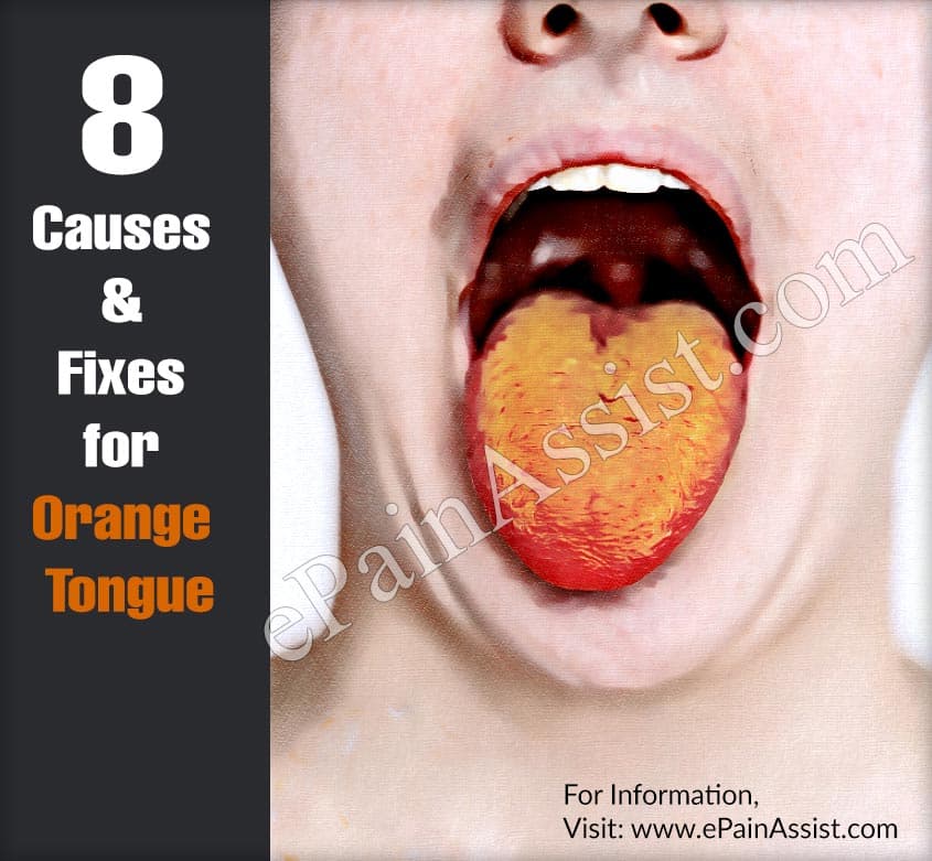 8 Causes &amp; Fixes for Orange Tongue