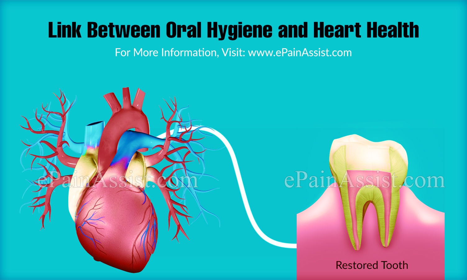 Link Between Oral Hygiene and Heart Health