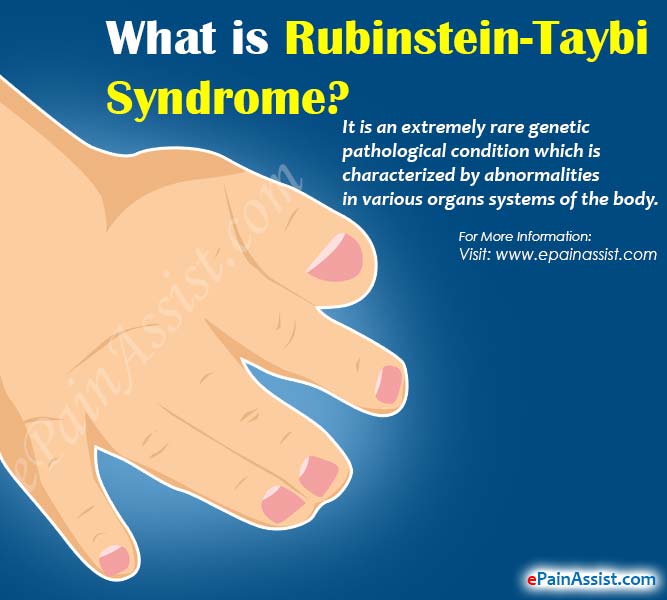 Síndrome de Rubinstein-Taybi • Neuraxis