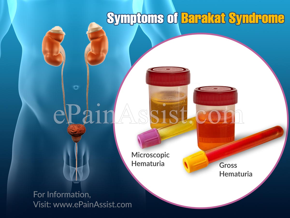 Symptoms of Barakat Syndrome