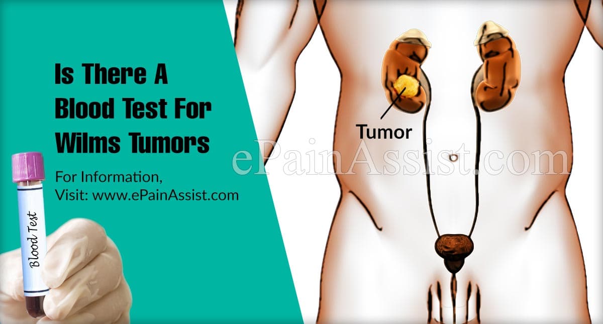 Is There A Blood Test For Wilms Tumors?