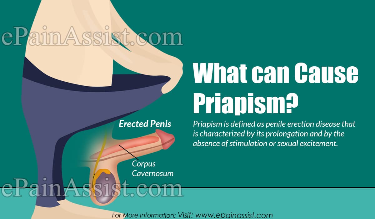 What can Cause Priapism?