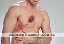 upper chest discomfort nsaid