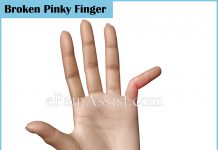 Finger Injuries Information Center|Boutonniere Deformity|Broken|Jersey ...