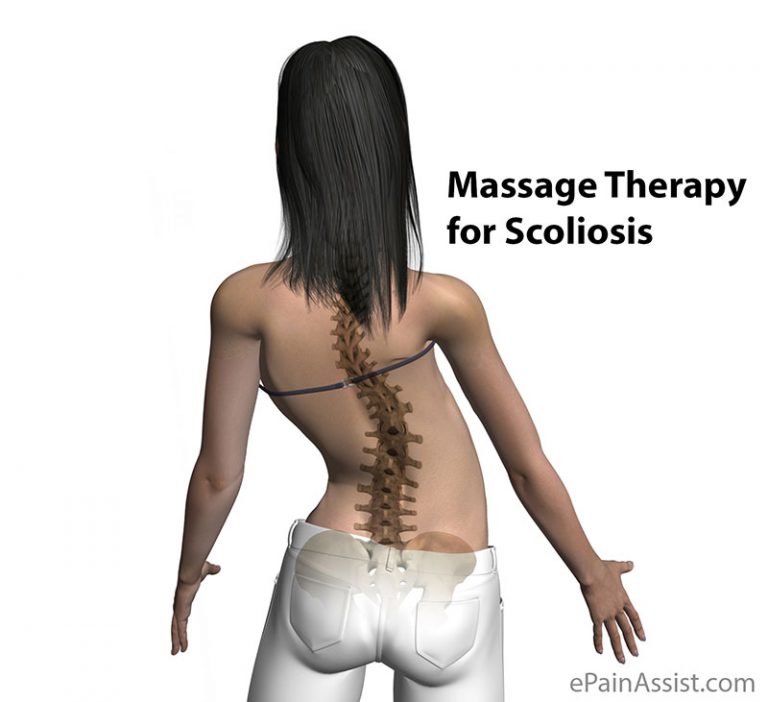 Massage Therapy for Scoliosis: Techniques, Symptoms, Signs, Prevention