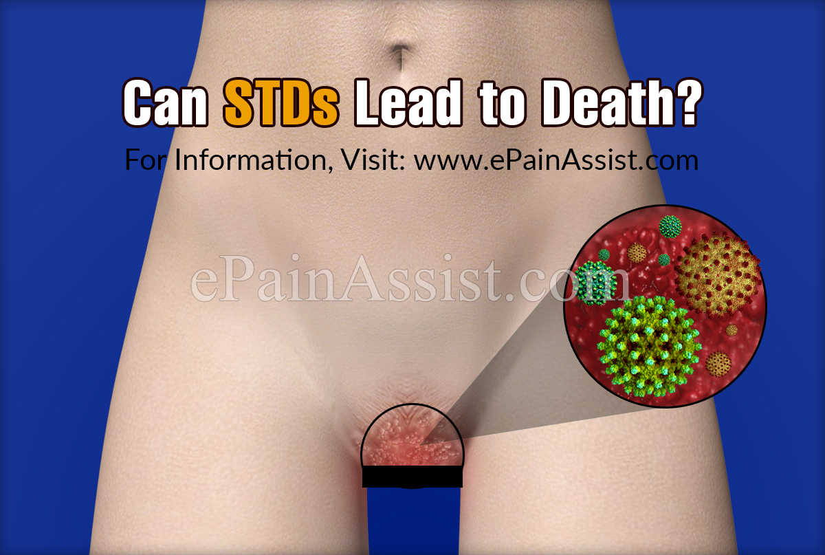 Can STDs Lead to Death?