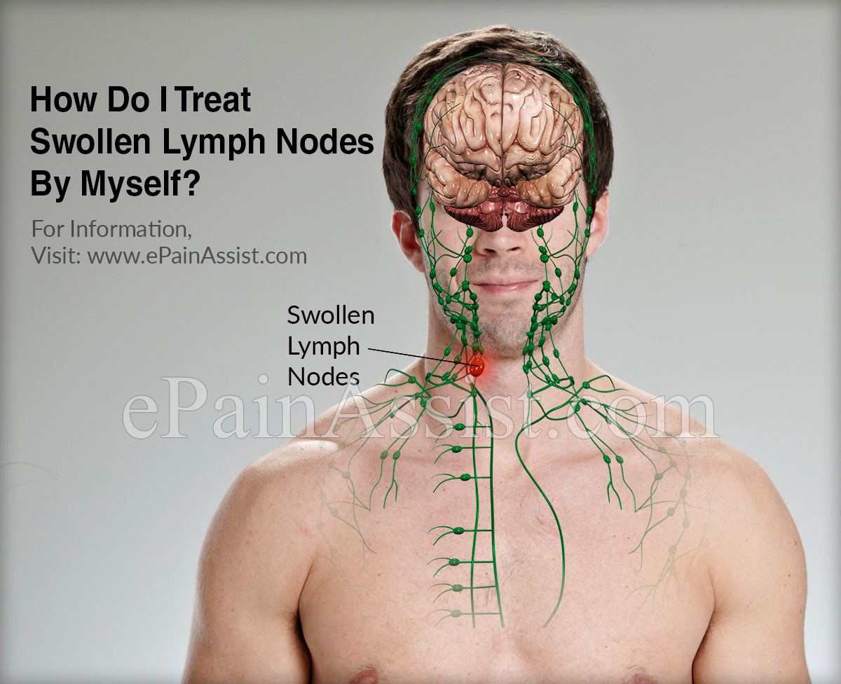 where are the lymph nodes in your neck