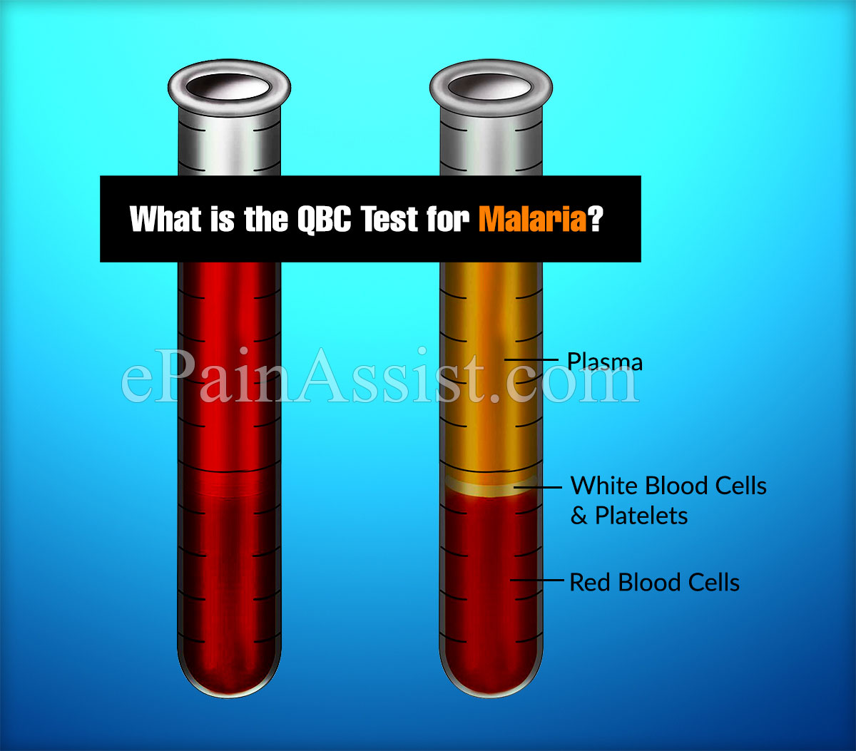 What is the QBC Test for Malaria?