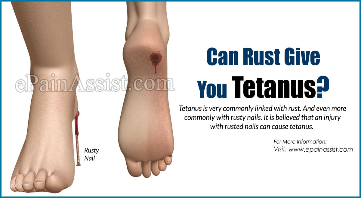 can you get tetanus from touching rust