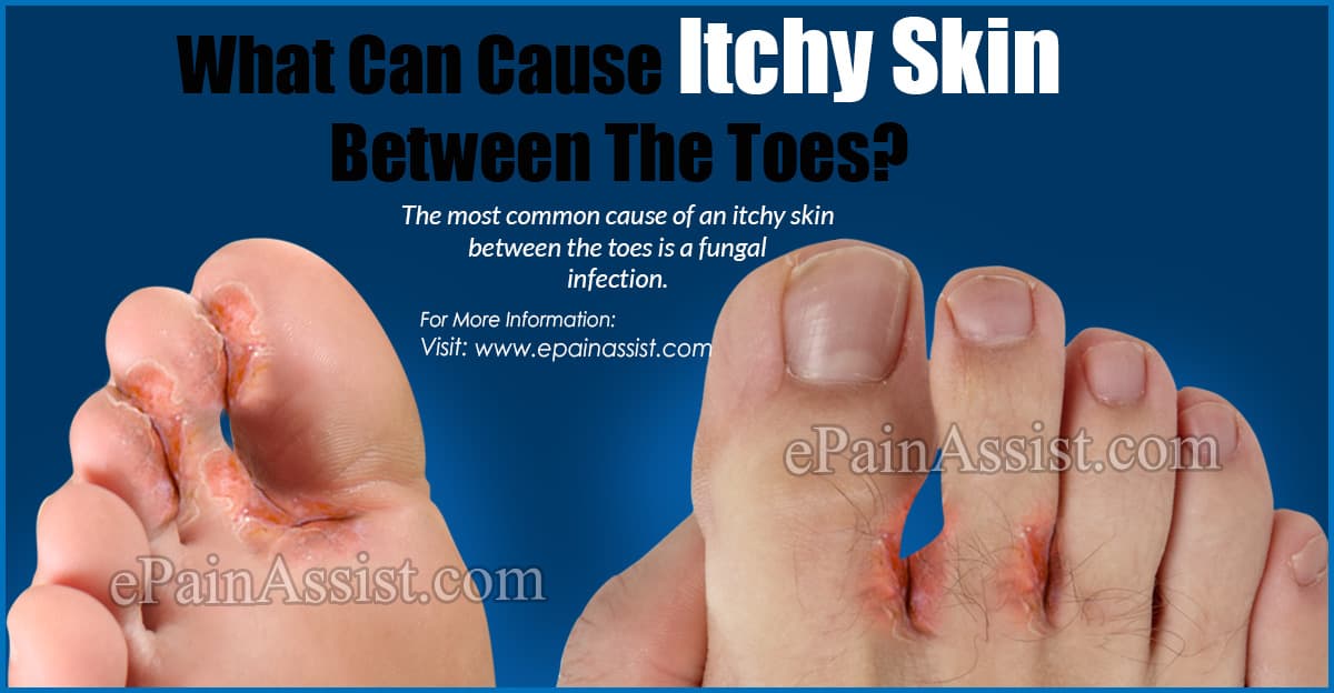 dead skin in between toes