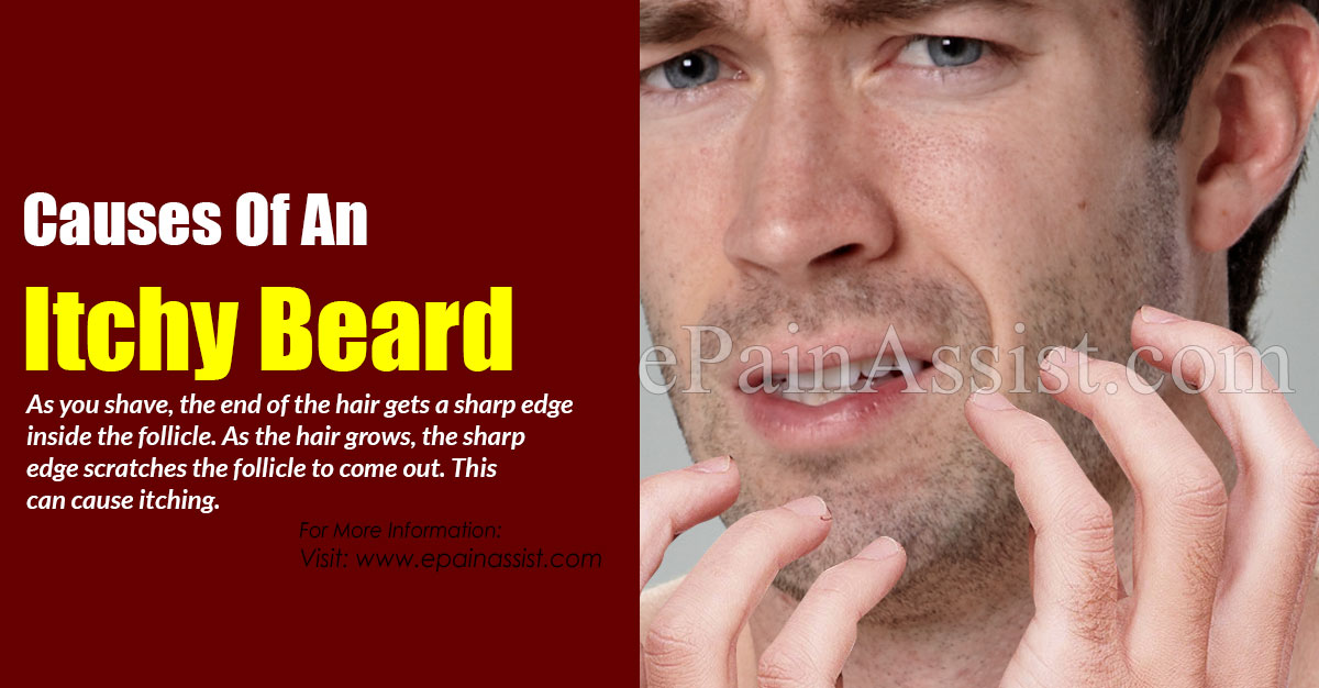Causes Of An Itchy Beard