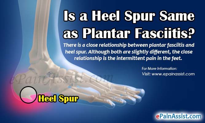 heel pain from plantar fasciitis