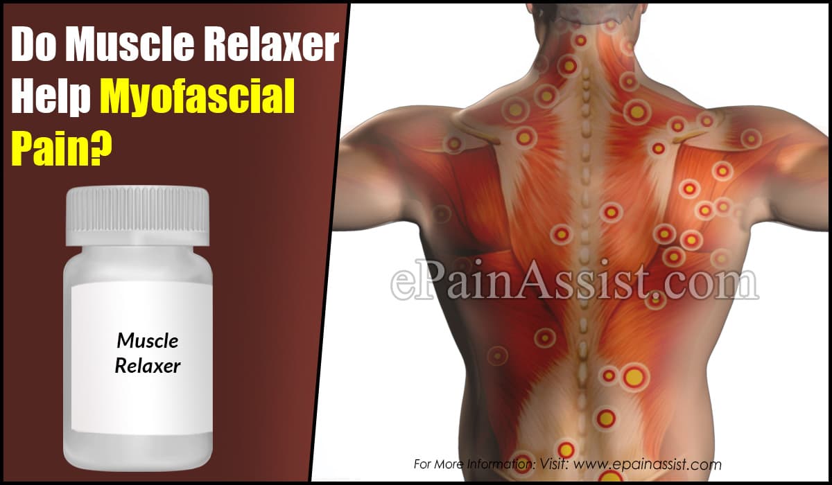 Do Muscle Relaxers Help Myofascial Pain?