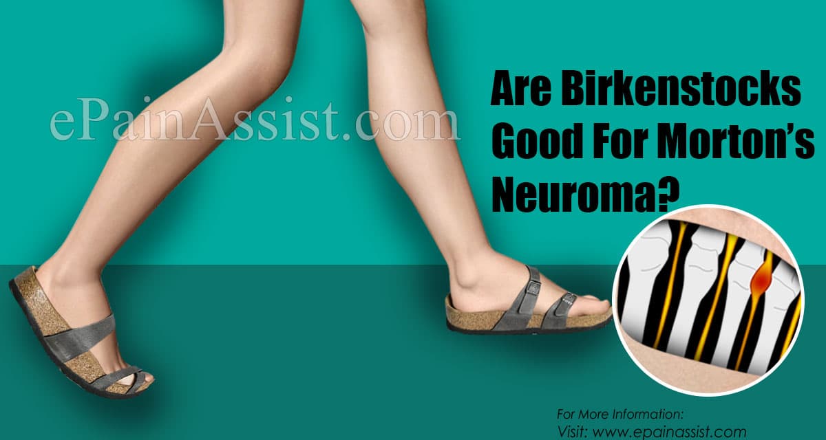 Are Birkenstocks Good For Morton's Neuroma?