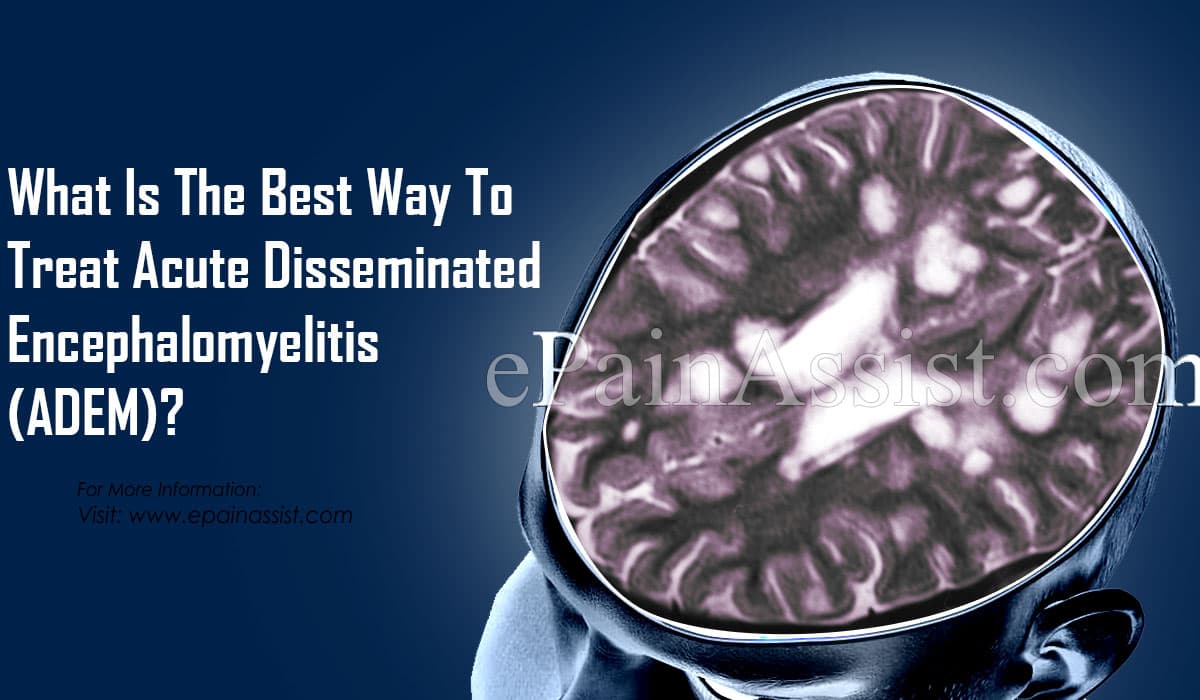What Is The Best Way To Treat Acute Disseminated Encephalomyelitis (ADEM)?