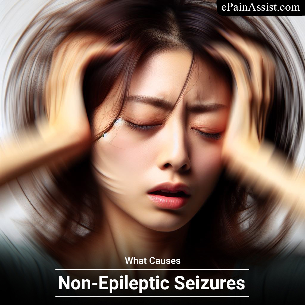 What Causes Non-Epileptic Seizures?