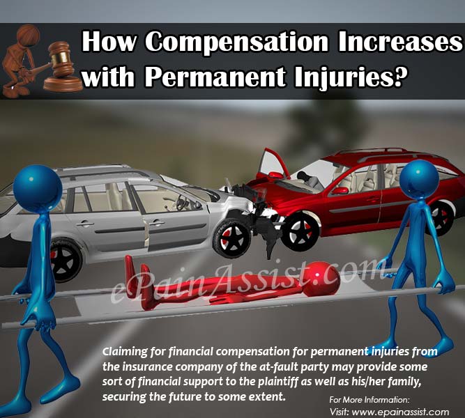 How Compensation Increases with Permanent Injuries?