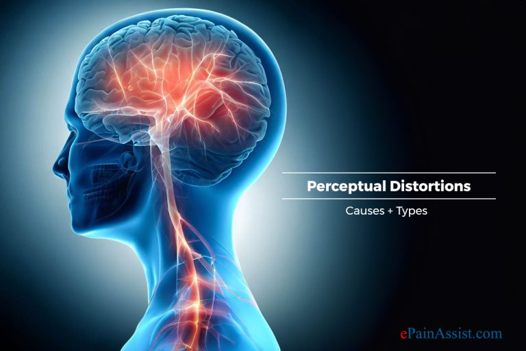 Understanding Perceptual Distortions : Causes, Types, and Impact on Daily Life