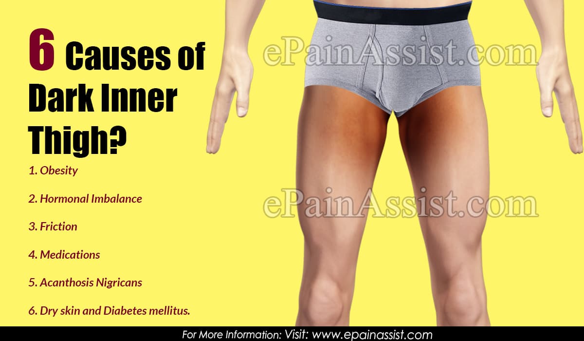 Dark Inner Thighs: Causes And Treatments