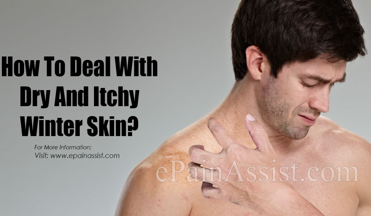 How To Deal With Dry And Itchy Winter Skin