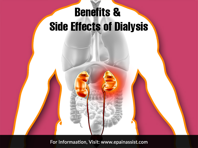 Benefits & Side Effects of Dialysis