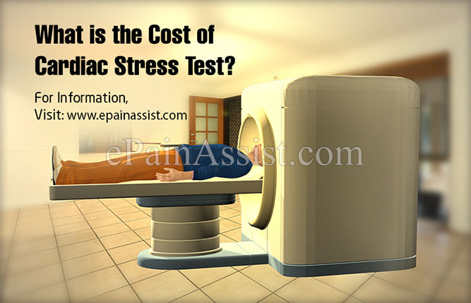 What is the Cost of Cardiac Stress Test?