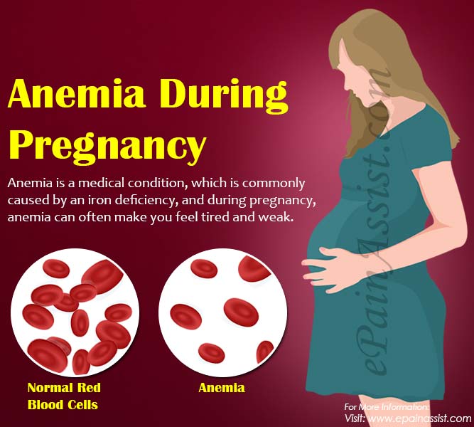 Anemia In Pregnant Women Group
