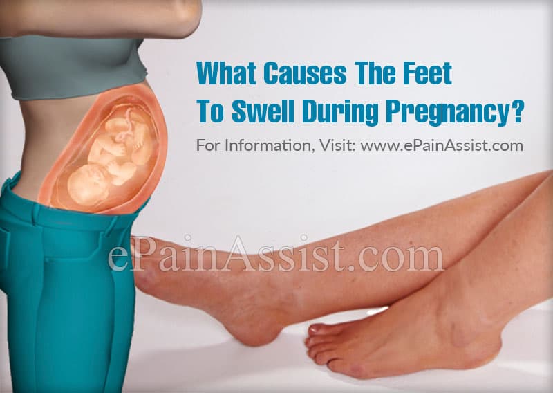 Swollen Feet During Pregnancy Causes And Relief Measures