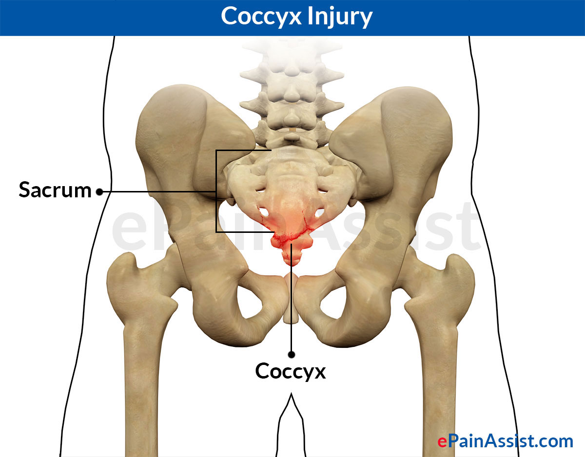 coccyx fracture pillow