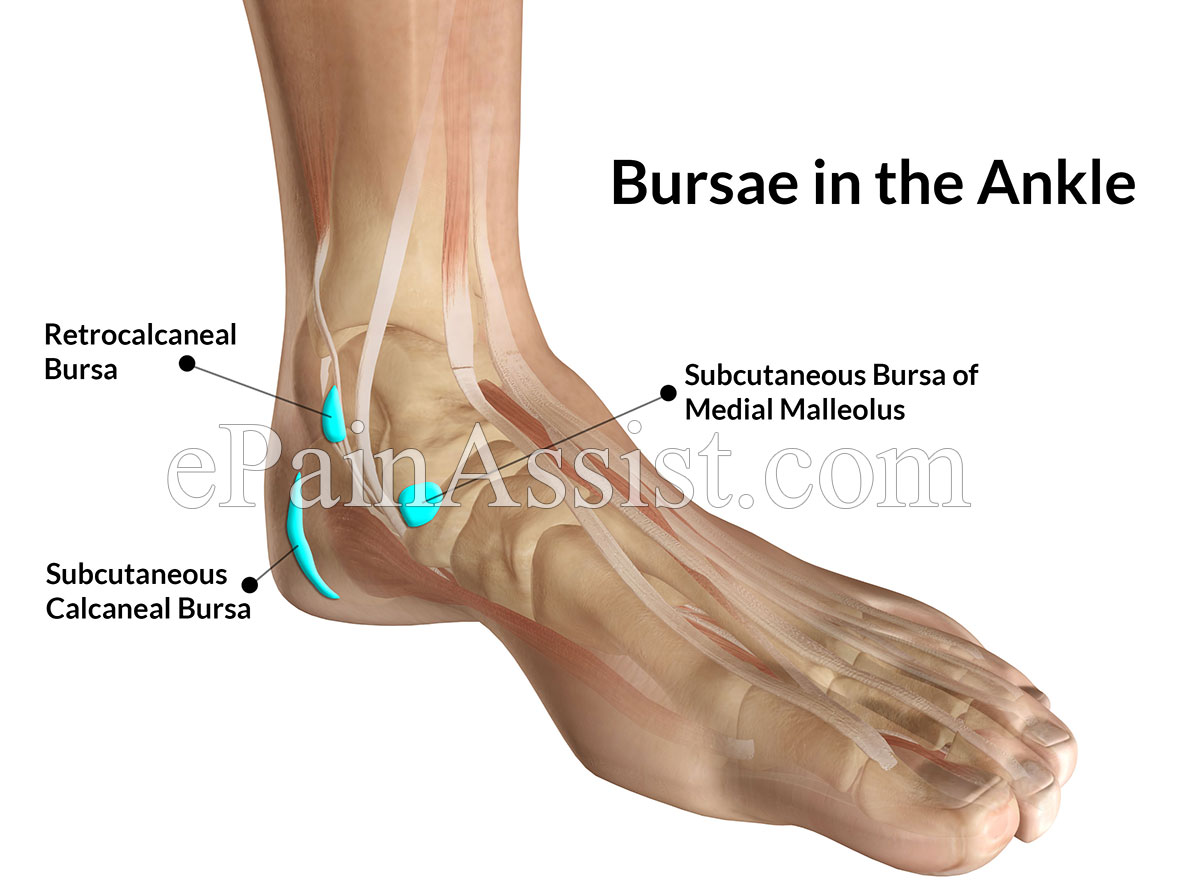 Ankle Joint Bursitis Causes Symptoms Treatment Conservative