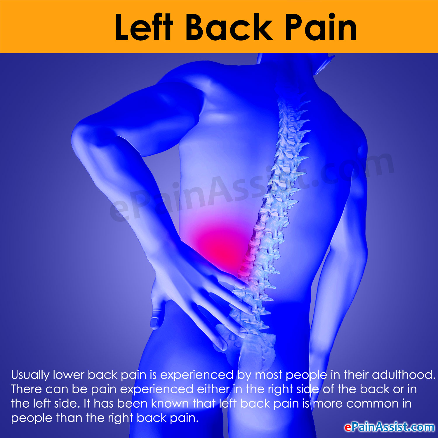 Illustration of Lower Back Pain Causes