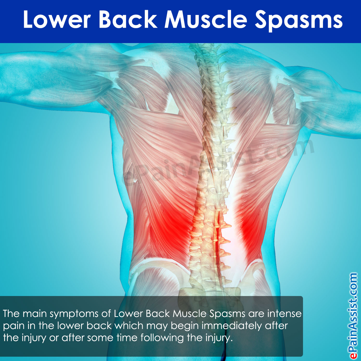 Understanding Lower Back Pain