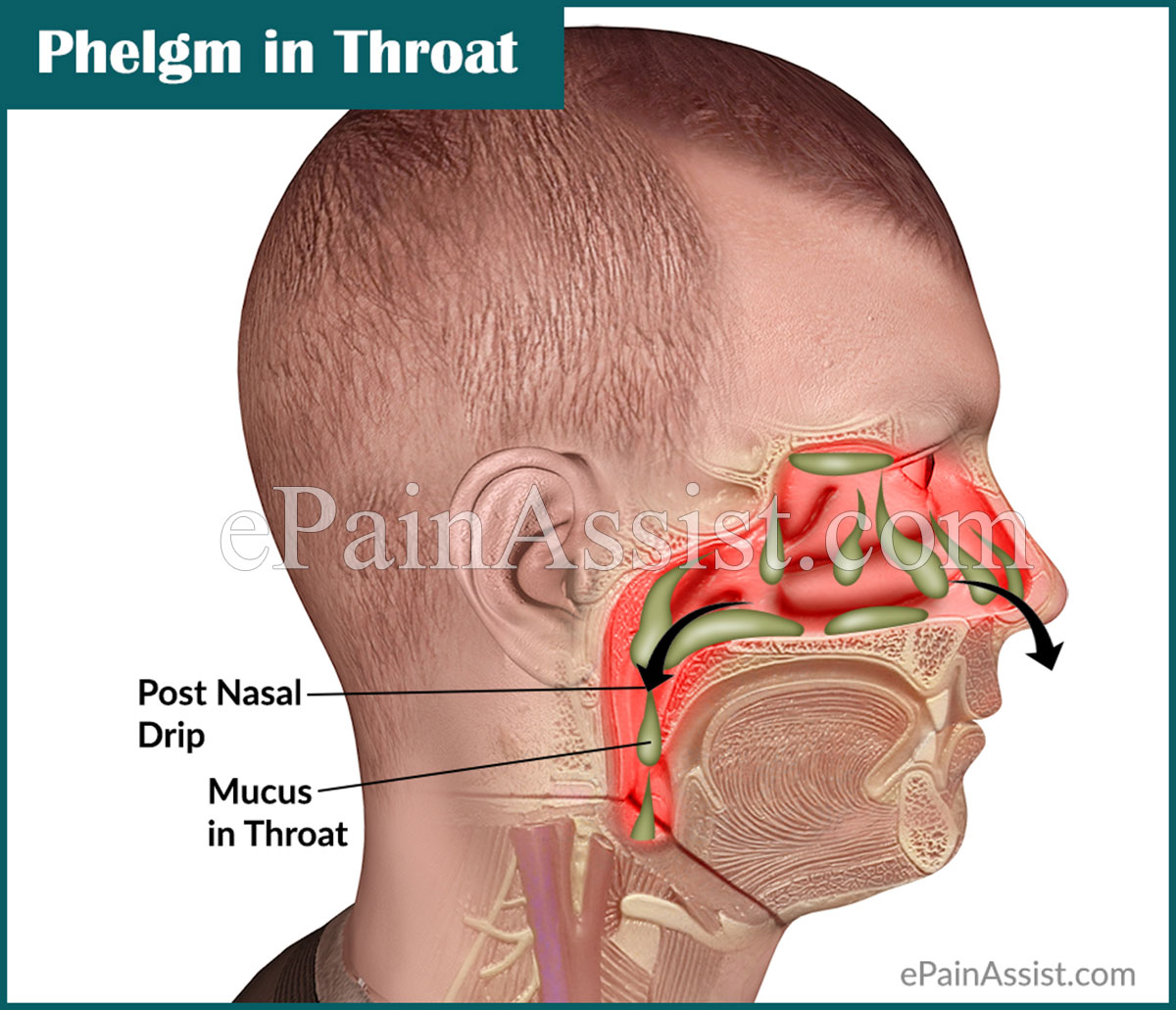 Phlegm in Throat or Mucus in Throat: Causes & Ways to Get of