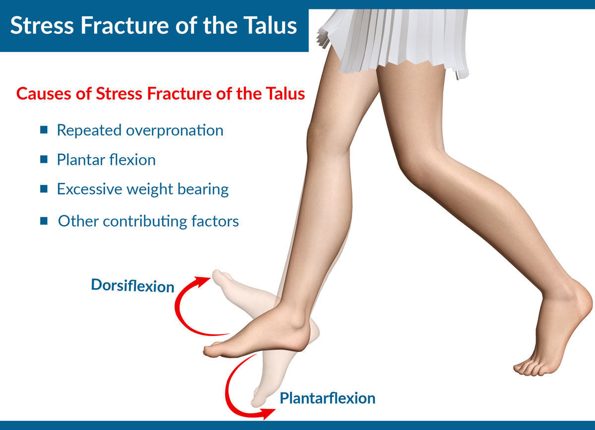 hairline fracture in ankle symptoms