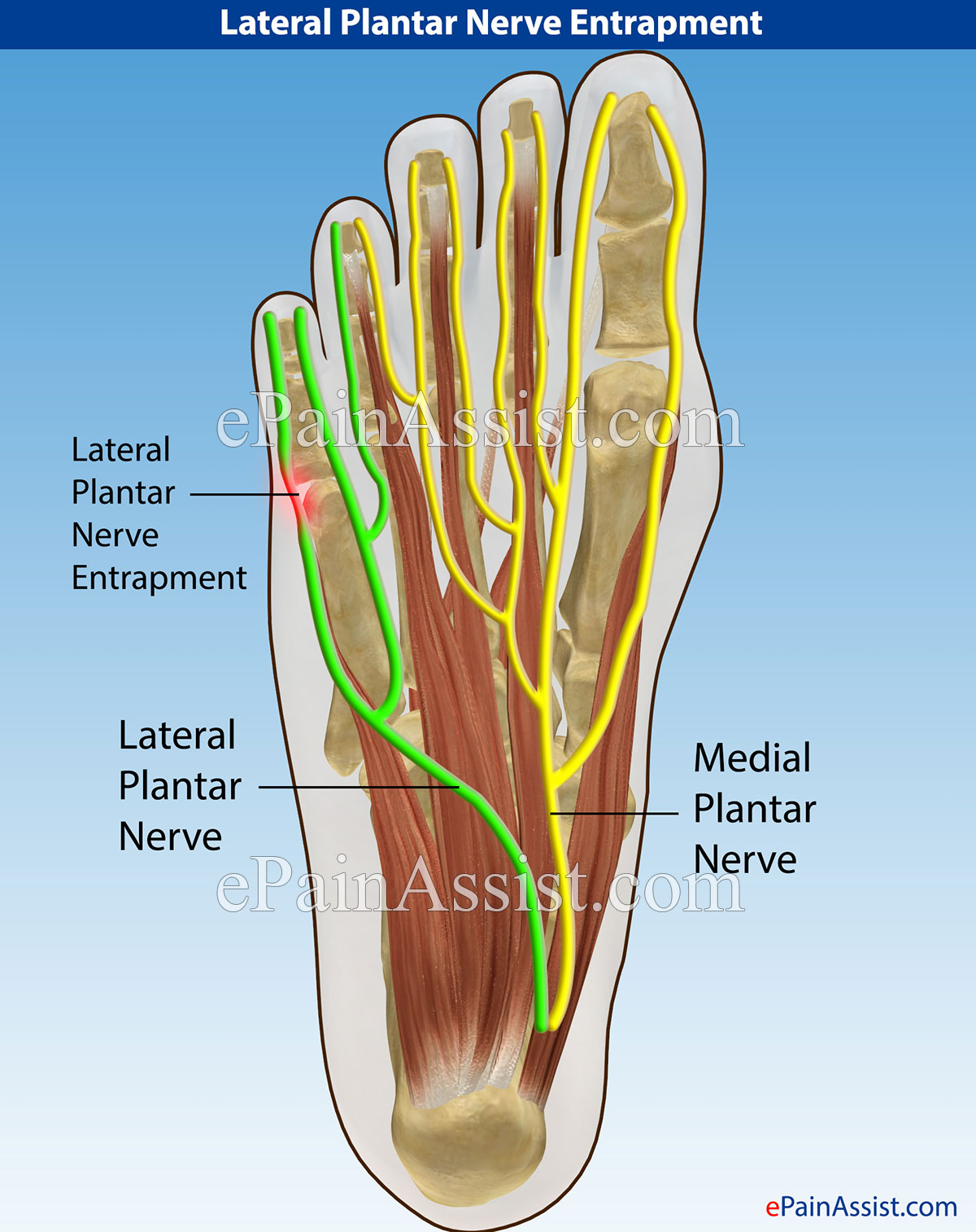 Medial Plantar Nerve Nerve Human Body Anatomy Body Anatomy | Images and ...